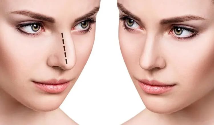 این مواد غذایی جوانی پوست را نابود می‌کند