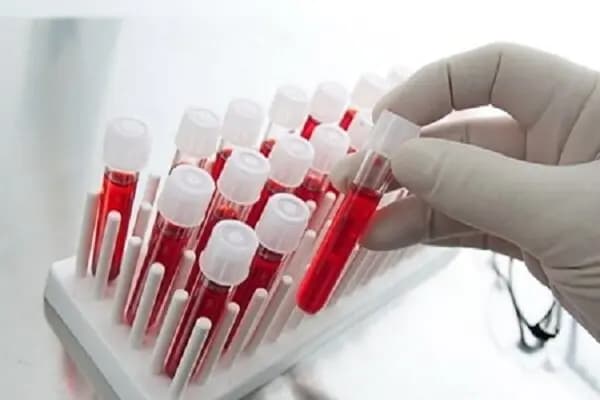 چرا برخی از افراد در میانسالی به زوال عقل مبتلا می‌شوند؟
