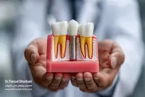 قیمت دلار بازار آزاد امروز یکشنبه ۴ خرداد ۱۴۰۴ +جدول