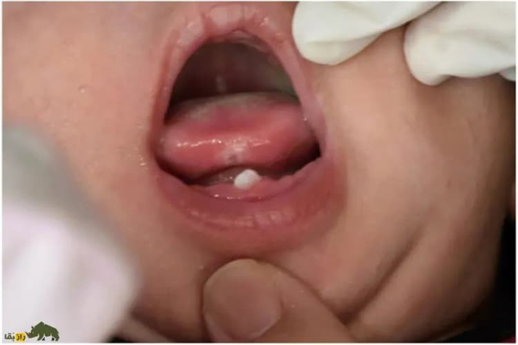 شدت تأثیر ذرات آلوده قابل تنفس بر سلامت انسان