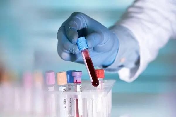 آخرین خبر از وضعیت تتلو