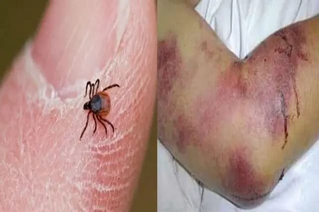 هشدار تابستانی؛ موج حمله کنه‌ها با گرمای هوا از راه رسید!