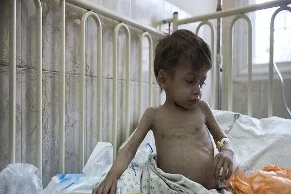 سازمان ملل: غزه در آستانه فاجعه انسانی!