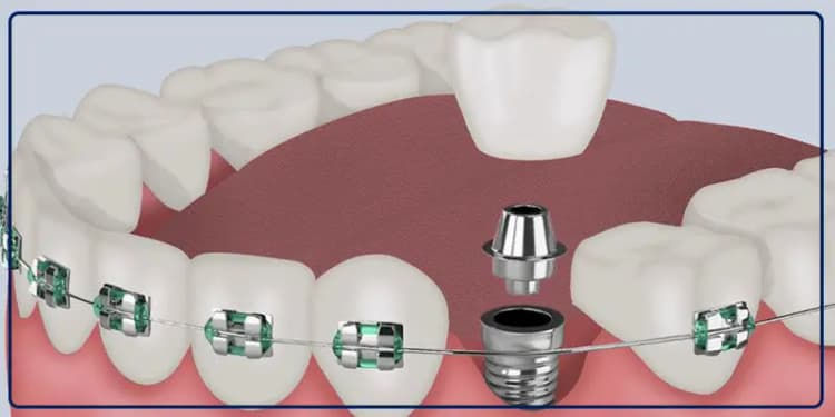 آتش‌سوزی یک ساختمان در تهران/ جزئیات